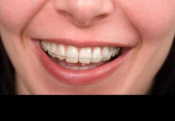 چگونه زیبایی دندانهای خود را حفظ کنیم